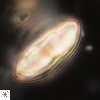 Discoaster delicatus 70858