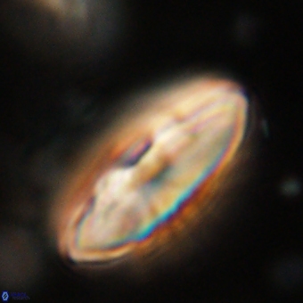 Discoaster delicatus 70859