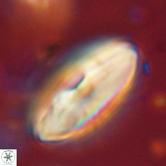 Discoaster delicatus 70860