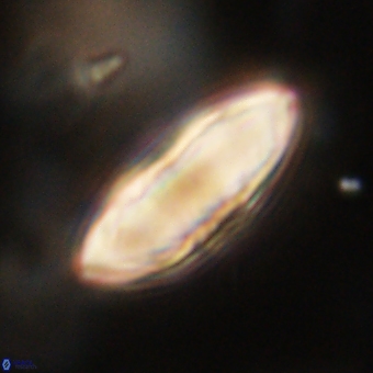 Discoaster delicatus 70862