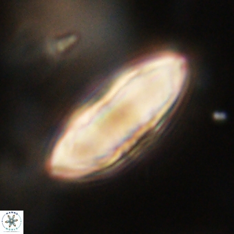 Discoaster delicatus 70862