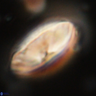 Discoaster delicatus 70863
