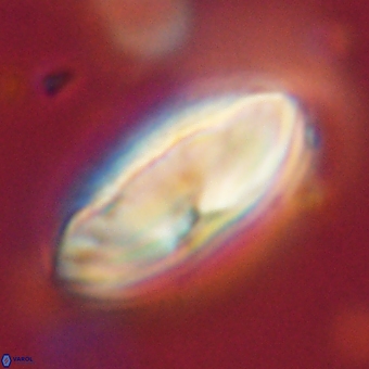 Discoaster delicatus 70864