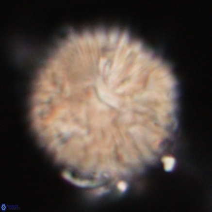 Discoaster delicatus 20814 1