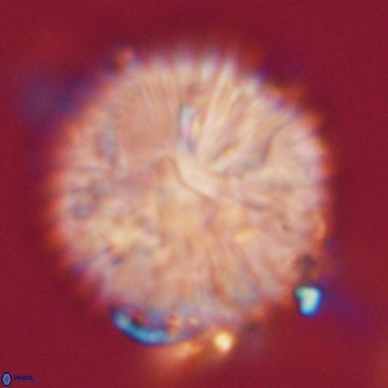 Discoaster delicatus 20815 1