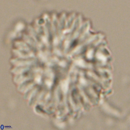 Discoaster delicatus 20816 1