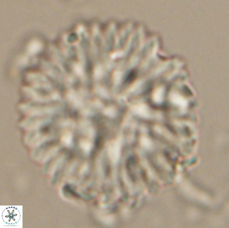 Discoaster delicatus 20816 1