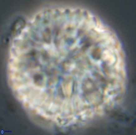 Discoaster delicatus 20817 1