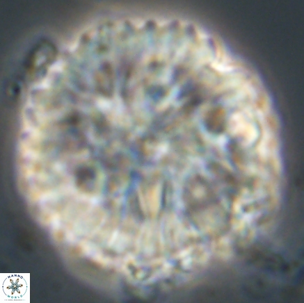 Discoaster delicatus 20817 1
