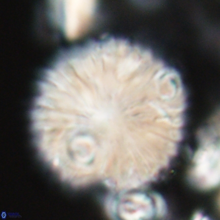 Discoaster delicatus 21496 1