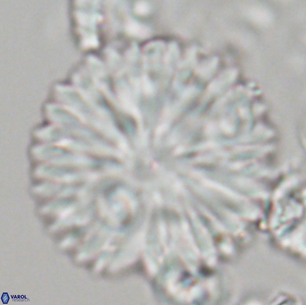 Discoaster delicatus 21498 1