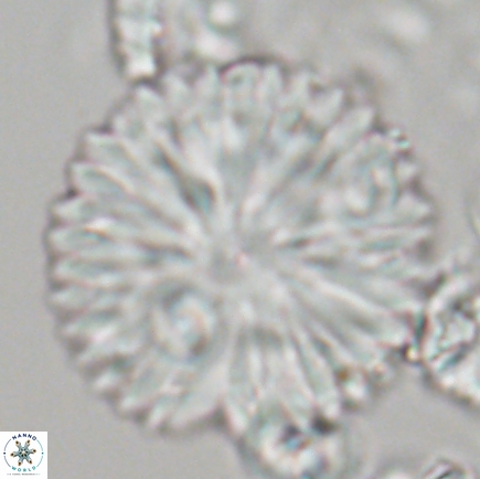 Discoaster delicatus 21498 1