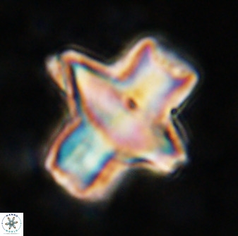 Discoaster diastypus 49300