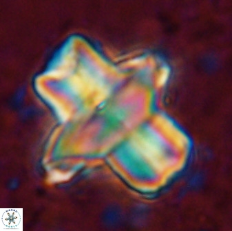 Discoaster diastypus 49304