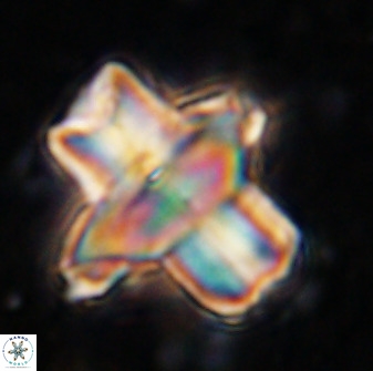 Discoaster diastypus 49305