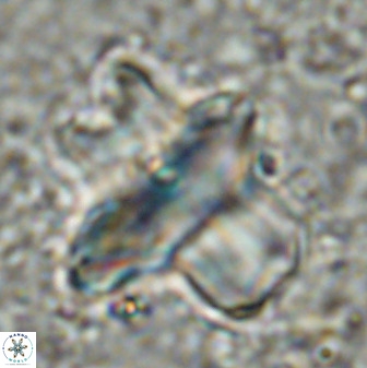 Discoaster diastypus 49306
