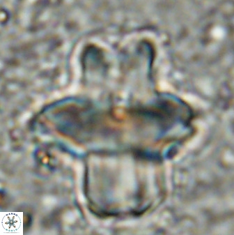 Discoaster diastypus 49307