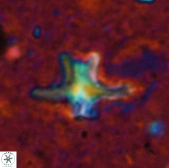 Discoaster diastypus 49491