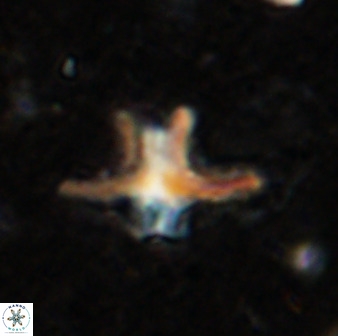 Discoaster diastypus 49492