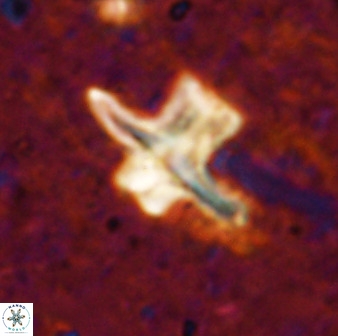 Discoaster diastypus 49494