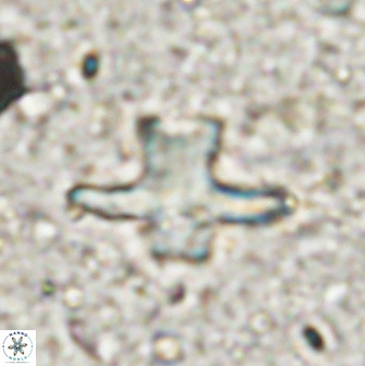 Discoaster diastypus 49495
