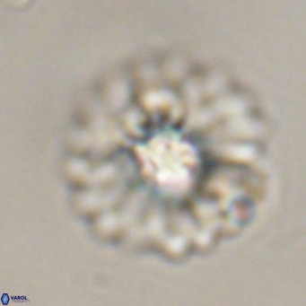 Discoaster diastypus VR 29097