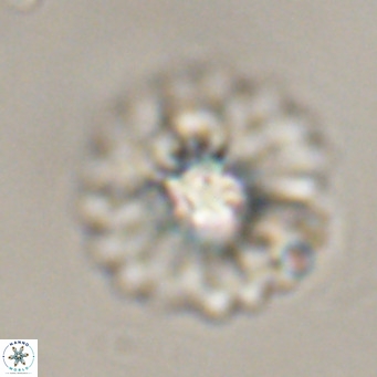 Discoaster diastypus VR 29097