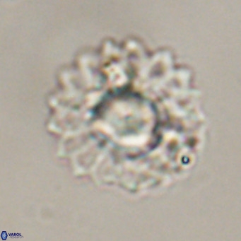 Discoaster diastypus VR 29098