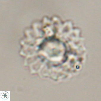 Discoaster diastypus VR 29098
