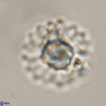 Discoaster diastypus VR 29099