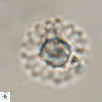 Discoaster diastypus VR 29099