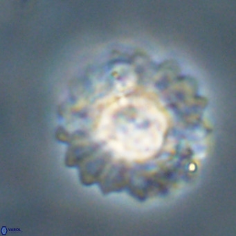 Discoaster diastypus VR 29100