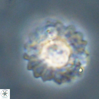 Discoaster diastypus VR 29100