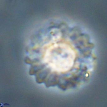 Discoaster diastypus VR 29101