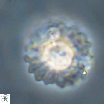Discoaster diastypus VR 29101