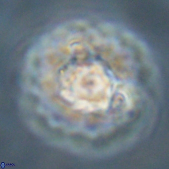 Discoaster diastypus VR 29102