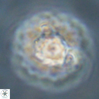 Discoaster diastypus VR 29102