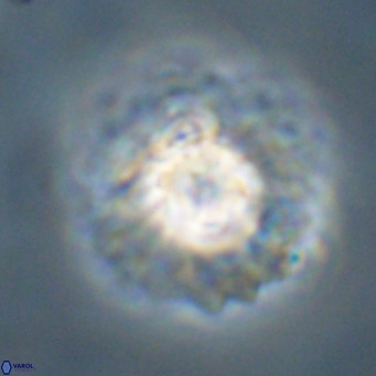 Discoaster diastypus VR 29103