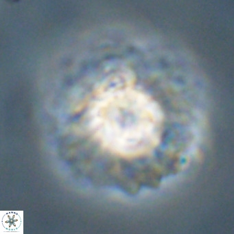 Discoaster diastypus VR 29103
