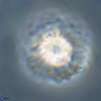 Discoaster diastypus VR 29104