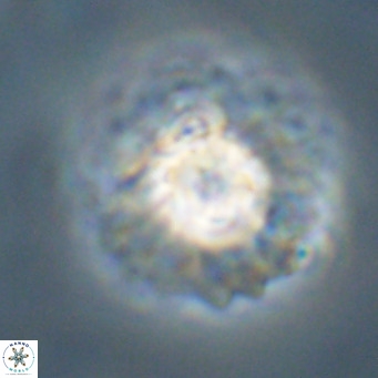 Discoaster diastypus VR 29104