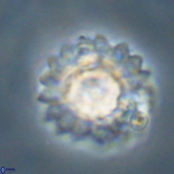 Discoaster diastypus VR 29105