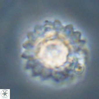 Discoaster diastypus VR 29105
