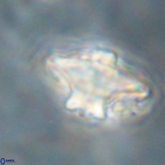 Discoaster diastypus VR 29106