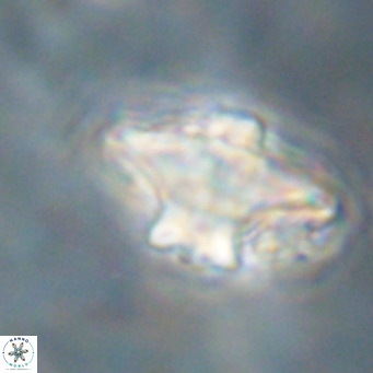 Discoaster diastypus VR 29106