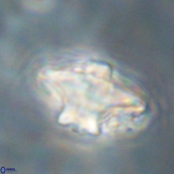 Discoaster diastypus VR 29107