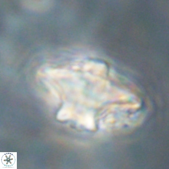 Discoaster diastypus VR 29107
