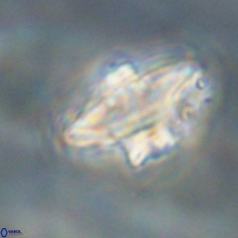 Discoaster diastypus VR 29108
