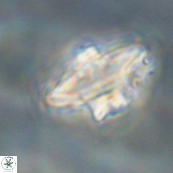 Discoaster diastypus VR 29108