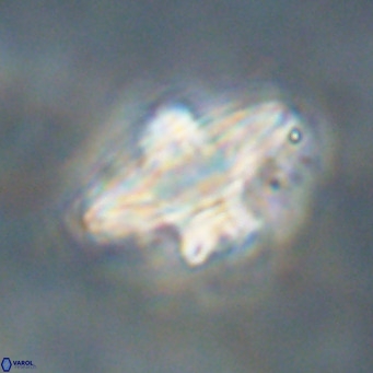 Discoaster diastypus VR 29109